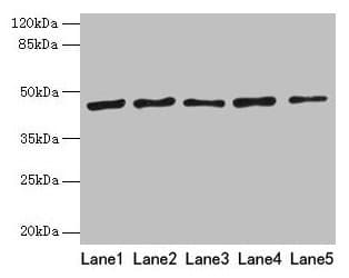 Polyclonal Rabbit anti-Human RRM2 Antibody (aa1-389, WB)