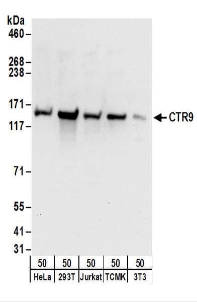 Polyclonal Rabbit anti-Human CTR9 Antibody (aa1123-1173, IHC, WB)