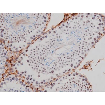 Polyclonal Rabbit anti-Human MAPT / Tau Antibody (phospho-Thr205, IHC, WB)