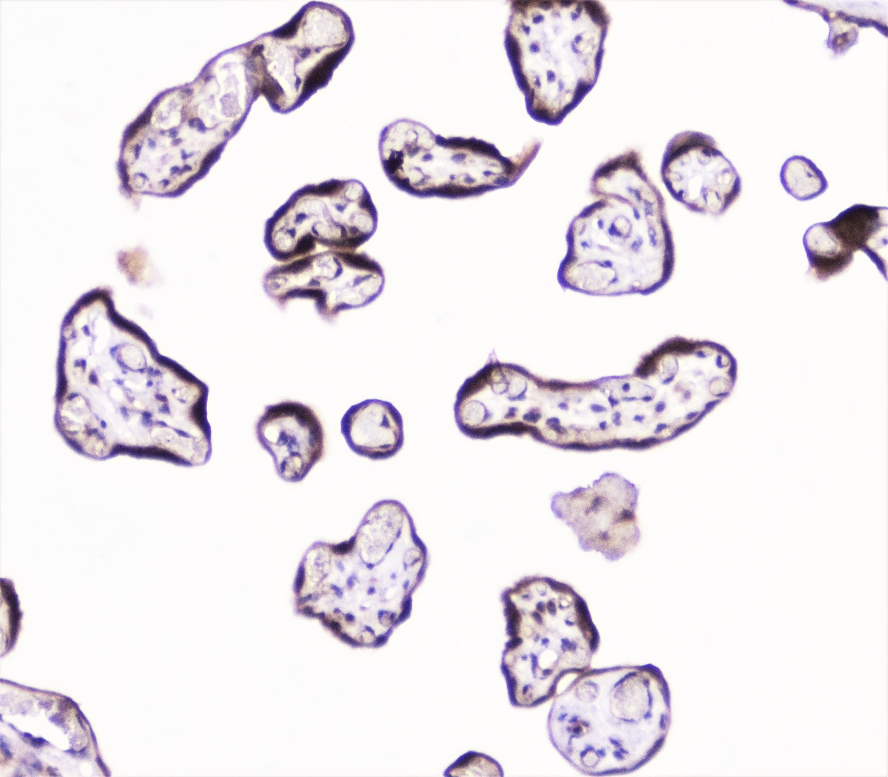 UBE2I / UBC9 Antibody
