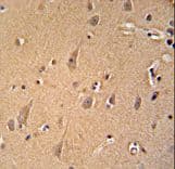 Polyclonal Rabbit anti-Human GCC2 Antibody (aa1581-1609, IHC, WB)