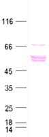 Human ESR2 / ER Beta Protein (Recombinant DDK,C-terminus)