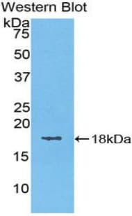 FLG2 Antibody (aa1915-2143)