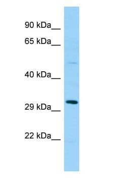 Polyclonal Rabbit anti-Human SPSB1 Antibody (aa95-144, WB)