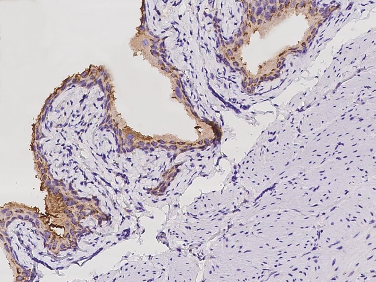 Polyclonal Rabbit anti-Mouse GLIS1 Antibody (IHC)
