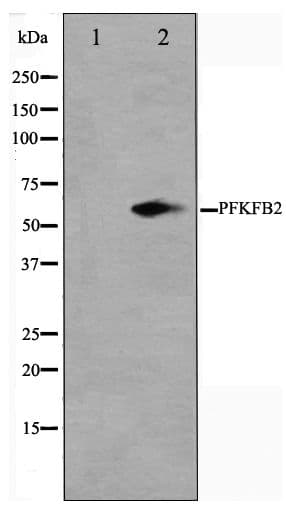 PFKFB2 Antibody