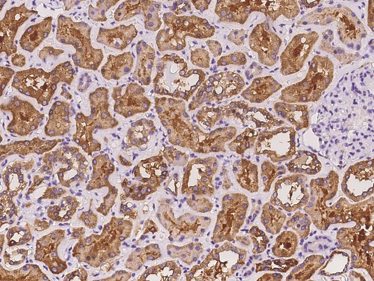ALDH1L1 Antibody