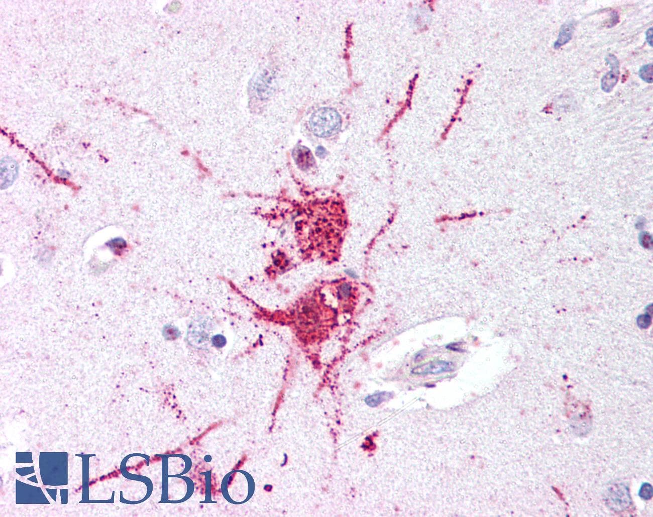 IHC-plus™ Polyclonal Rabbit anti-Human GPR52 Antibody (C-Terminus, IHC)