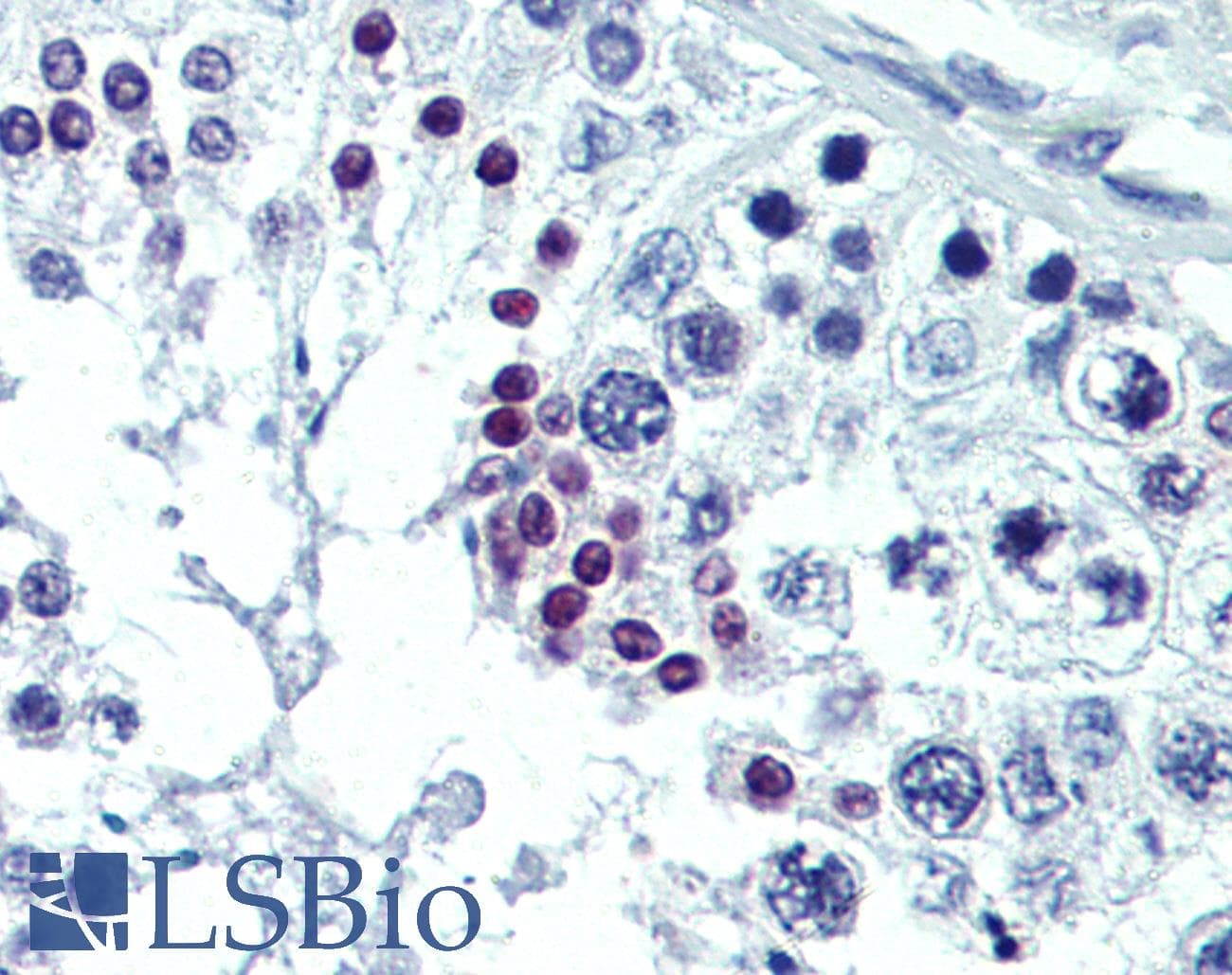 IHC-plus™ Polyclonal Rabbit anti-Human GLE1 Antibody (IHC, IF, WB)