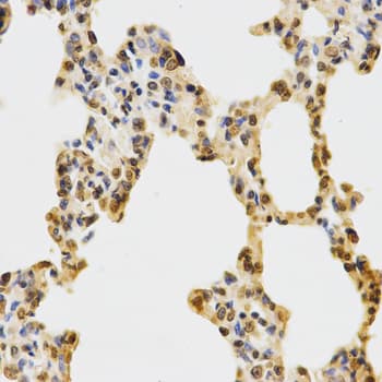 Polyclonal Rabbit anti-Human Histone H3 Antibody (Methyl-Lys27, IHC, IF, WB)