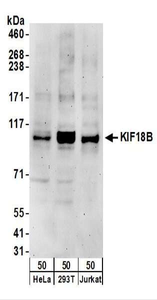 Polyclonal Rabbit anti-Human KIF18B Antibody (aa802-852, WB)