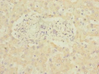 ADGRG6 / GPR126 Antibody