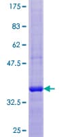 Human GALNT1 Protein (Recombinant GST)