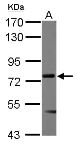 Polyclonal Rabbit anti-Human MEN1 / Menin Antibody (WB)