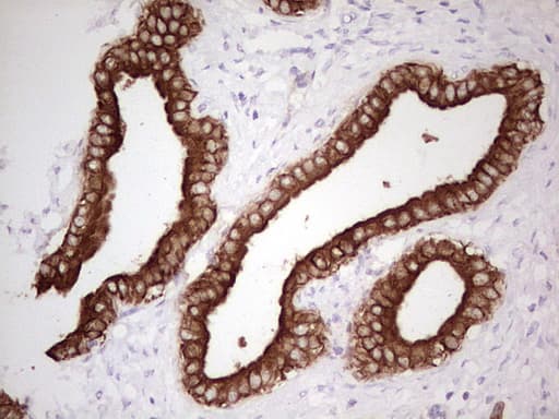 ABCB1 / MDR1 / P Glycoprotein Antibody (aa995-1280, clone OTI8A9, Carrier-free)