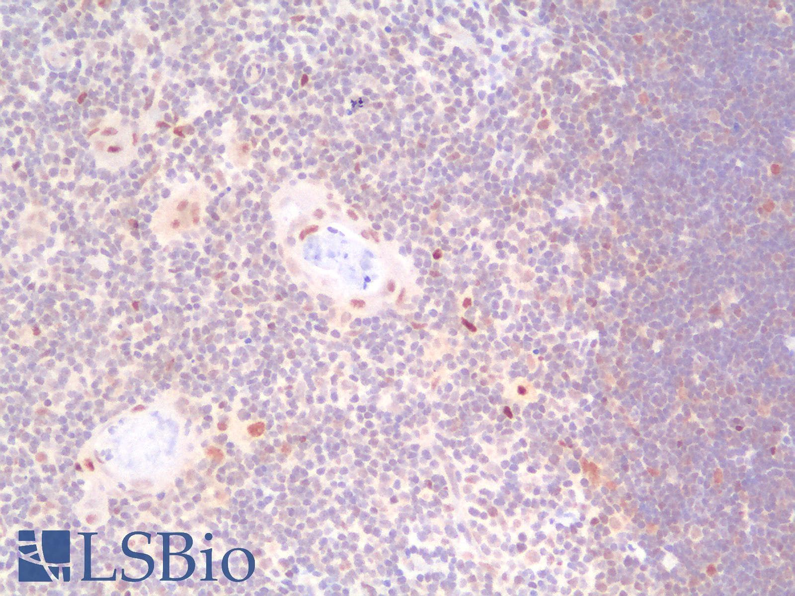PathPlus™ TP53 / p53 Antibody (clone rTP53/1739)