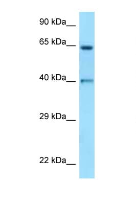 ANGPT1 / Angiopoietin-1 Antibody (N-Terminus)