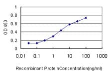 IHC-plus™ Monoclonal Mouse anti-Human GSTA3 Antibody (clone 1F11, IHC, WB)