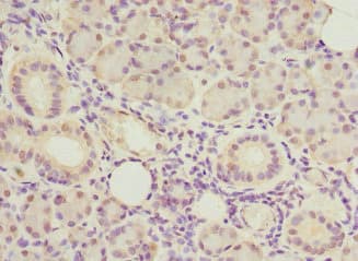 UBXD9 / ASPL Antibody