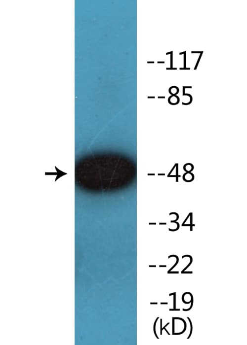 Polyclonal Rabbit anti-Human SMAD3 Antibody (phospho-Ser208, IHC, WB)