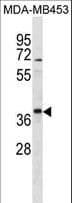 TFG Antibody (aa85-114)