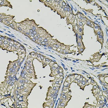 SMN2 Antibody
