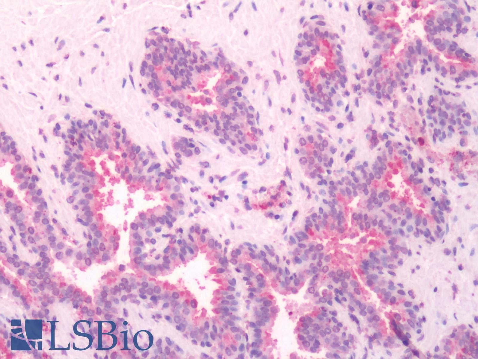 IHC-plus™ Polyclonal Rabbit anti-Human GPRC5A / RAI3 Antibody (Cytoplasmic Domain, IHC)