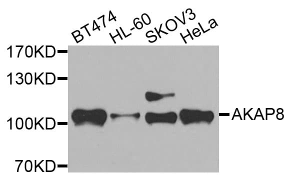 Polyclonal Rabbit anti-Human AKAP8 / AKAP95 Antibody (AP, IHC, WB)
