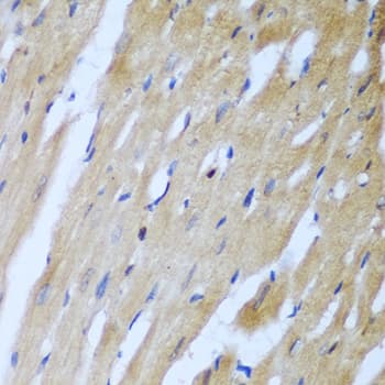 Rho Kinase / ROCK1 Antibody