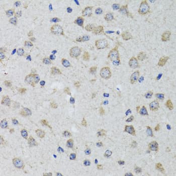 HTR3A / 5-HT3A Receptor Antibody