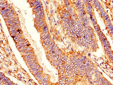 BCL2L1 / BCL-XL Antibody (aa1-209)