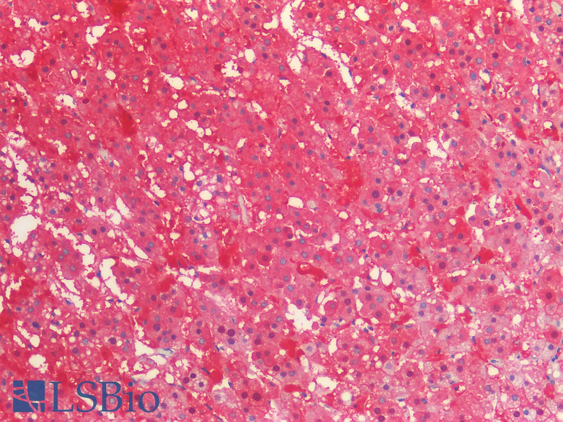PathPlus™ Monoclonal Mouse anti-Human IDH1 / IDH Antibody (clone C12, IHC, WB)