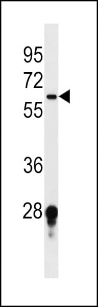 Polyclonal Rabbit anti-Human FUT11 Antibody (aa204-233, WB)