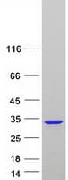 Human PAFAH1B3 Protein (Recombinant Myc-DDK (Flag))