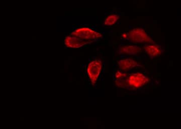 RAB6C Antibody