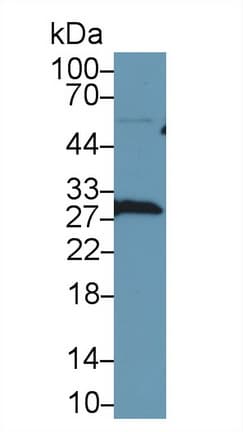 Latexin / MUM Antibody (aa1-222)
