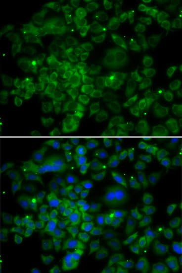 CCL2 / MCP1 Antibody