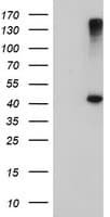 AGPAT5 Antibody (clone OTI1D12)