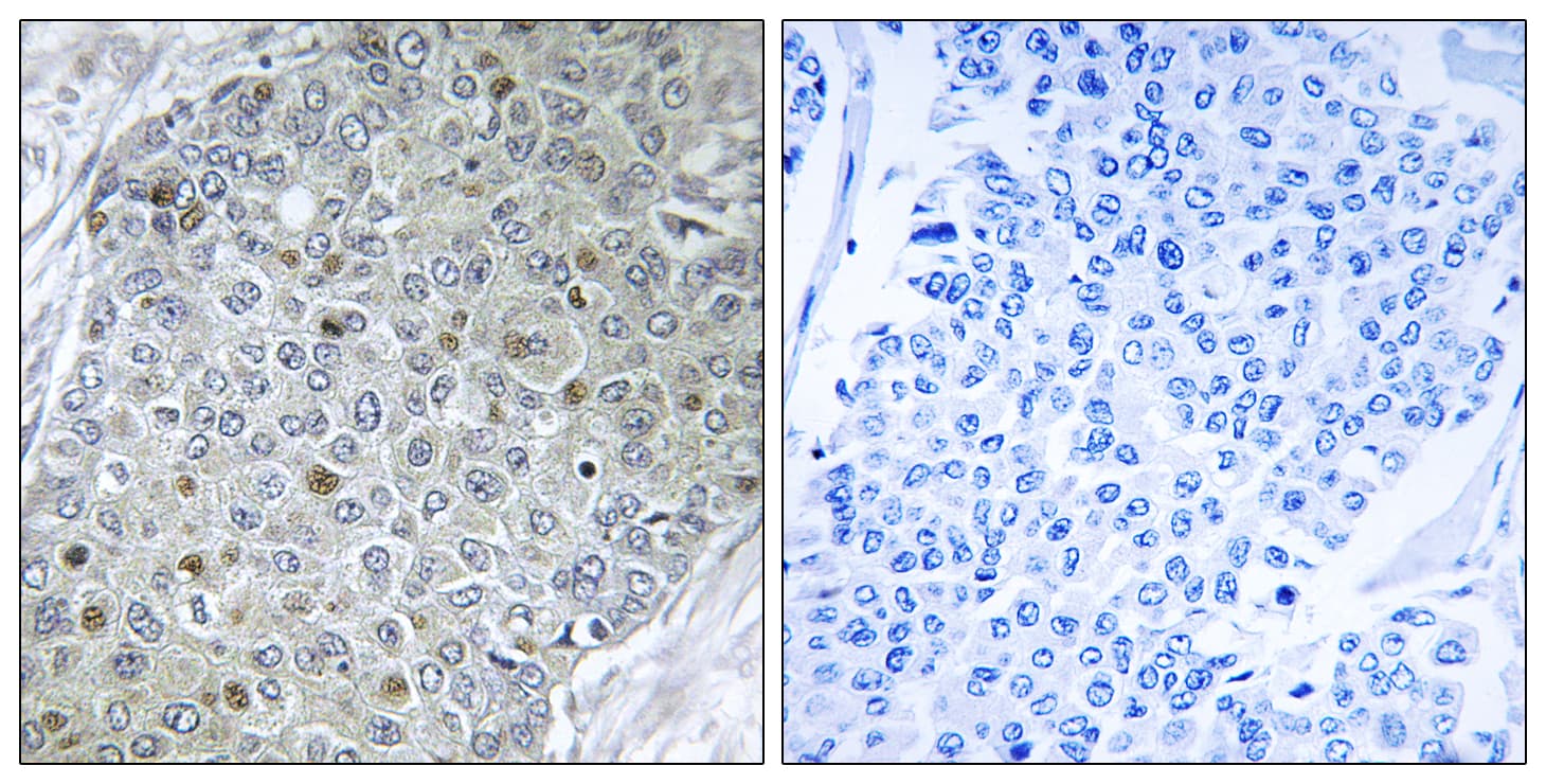 Polyclonal Rabbit anti-Human PEA3 / ETV4 Antibody (aa281-330, IHC)
