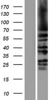 HSET / KIFC1 Protein (Over-Expression Lysate Myc-DDK (Flag))