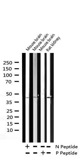 NFKBIB / IKB Beta / IKBB Antibody (phospho-Ser23)