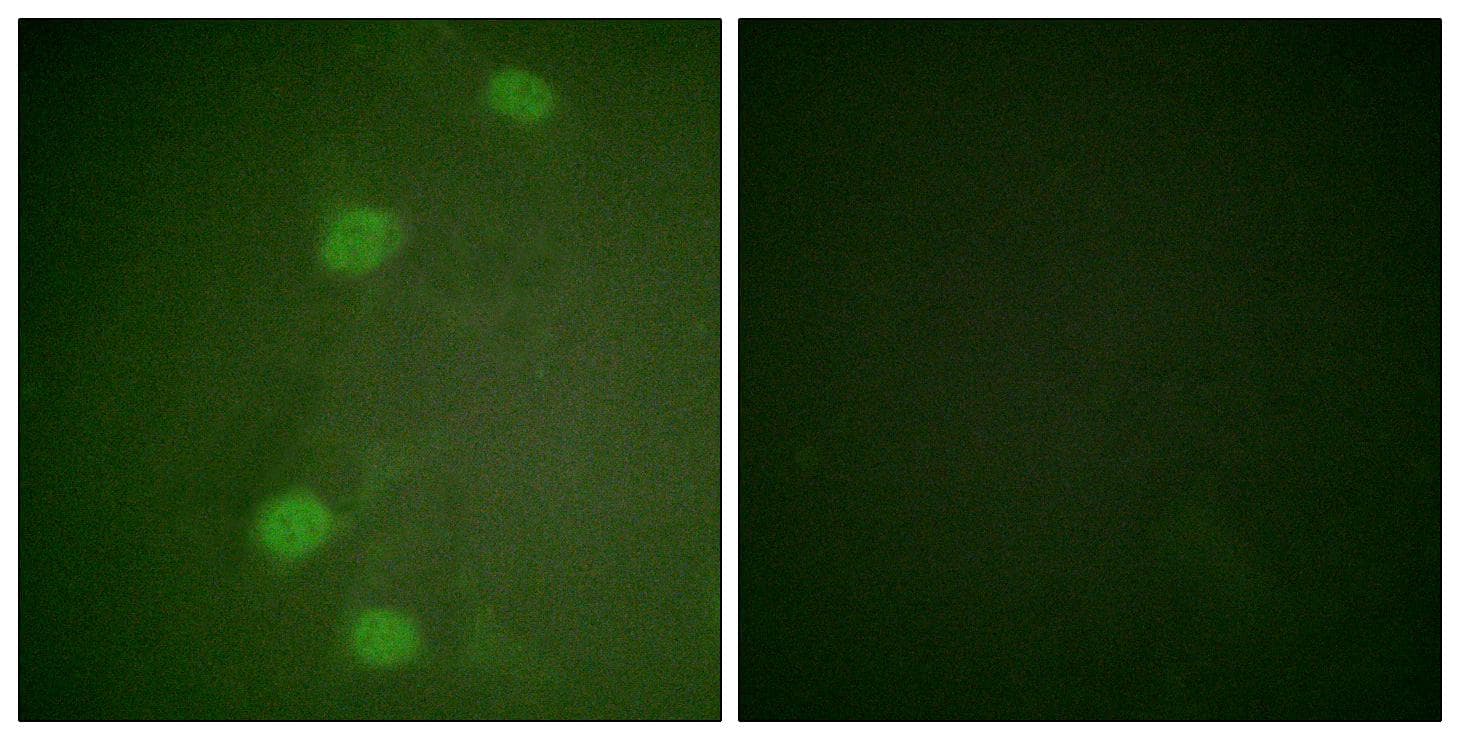 RB1 / Retinoblastoma / RB Antibody (phospho-Ser249)