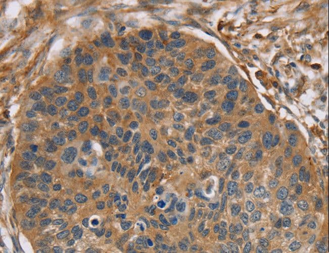 Polyclonal Rabbit anti-Human RIP4 / ANKRD3 Antibody (IHC)