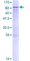 Human CDK19 / CDK11 Protein (Recombinant GST)