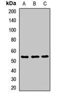 Polyclonal Rabbit anti-Human IMPDH1 Antibody (WB)