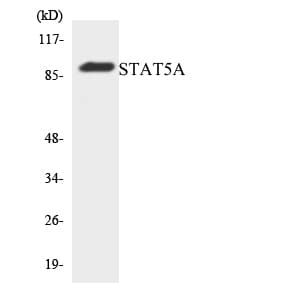 Polyclonal Rabbit anti-Human STAT5A Antibody (aa371-420, WB)