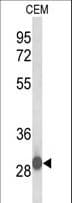 Polyclonal Rabbit anti-Human C15orf29 Antibody (aa47-73, WB)
