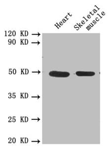 PLAU / Urokinase / uPA Antibody