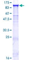 Human PYGL Protein (Recombinant GST)