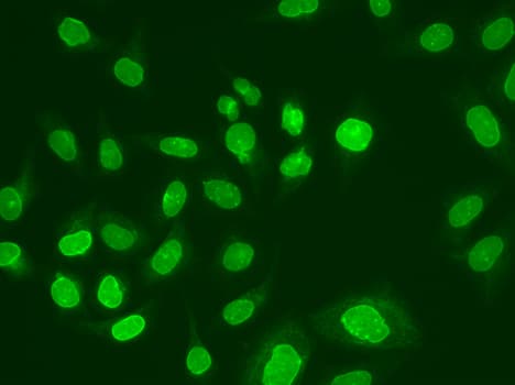 IHC-plus™ UEV1 / UEV1A Antibody